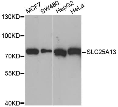 Polyclonal Rabbit anti-Human SLC25A13 / CITRIN Antibody (IHC, IF, WB)