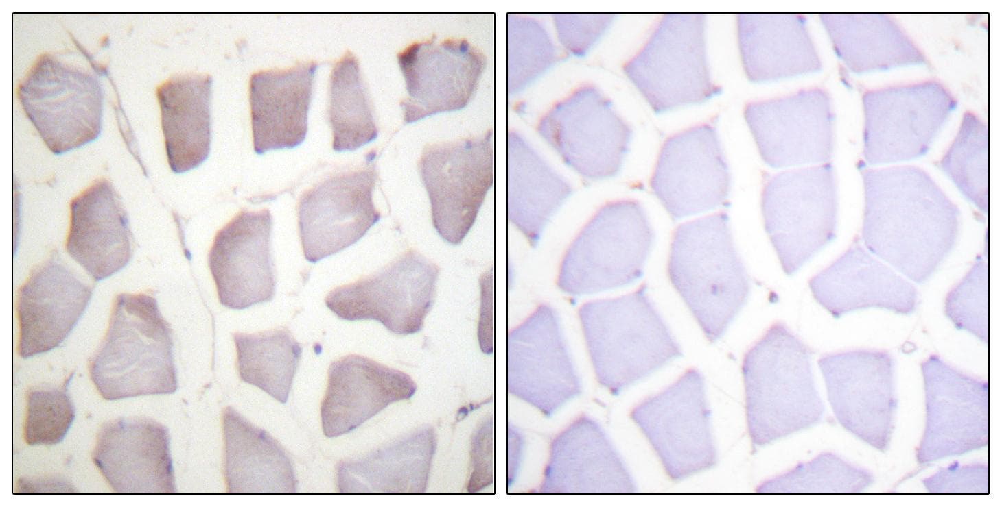 CRYAB / Alpha B Crystallin Antibody (phospho-Ser59)