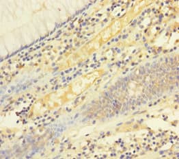 FASLG / Fas Ligand Antibody (aa103-281)