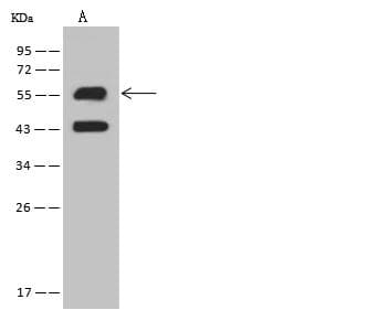 KRT6A / CK6A / Cytokeratin 6A Antibody