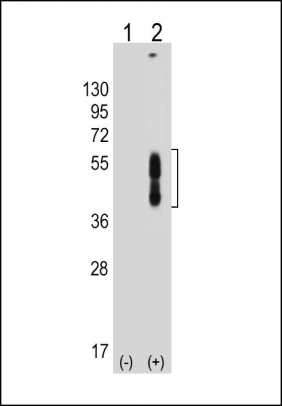 PD-L2 / PDCD1LG2 / CD273 Antibody (N-Terminus, clone 2011CT786.31.38)
