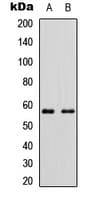 CYP11B2 / Aldosterone Synthase Antibody (Internal)