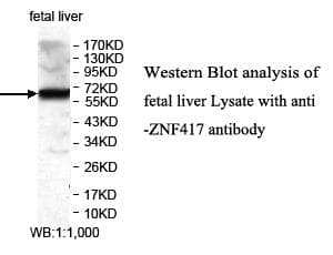 Polyclonal Rabbit anti-Human ZNF417 Antibody (aa169-425, WB)