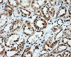 Monoclonal Mouse anti-Human SRR / Serine Racemase Antibody (clone OTI5D10, IHC, WB)
