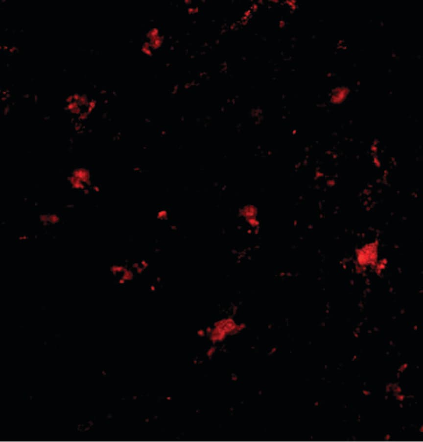 BAIAP3 Antibody