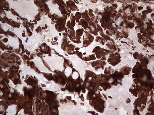PKM2 Antibody (clone OTI12D5, Carrier-free)