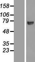 CTPS Protein (Over-Expression Lysate Myc-DDK (Flag))
