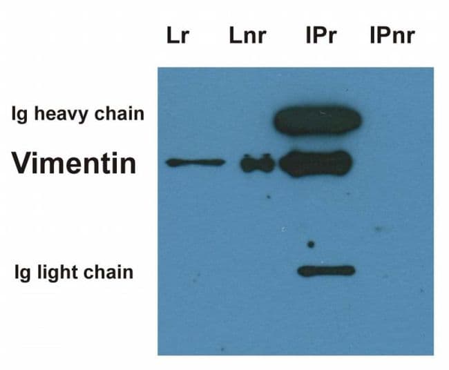 Vimentin Antibody (clone VI-01)