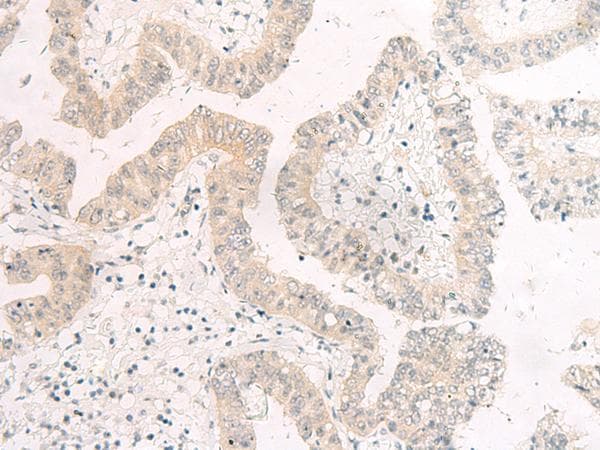 GSG2 / HASPIN Antibody
