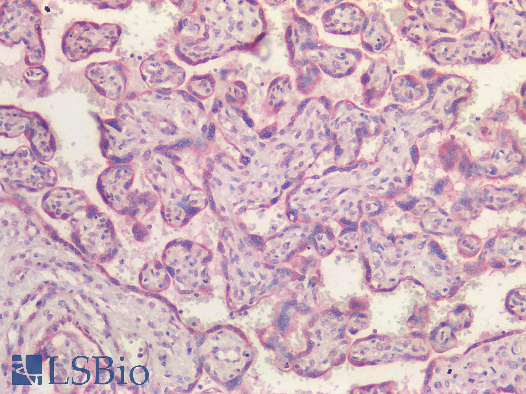IHC-plus™ VPS35 Antibody (Internal Region)
