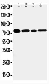 TNFRSF1B / TNFR2 Antibody (aa38-55)