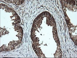 MSI2 Antibody (clone OTI2F10)