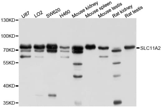 SLC11A2 / DMT1 Antibody