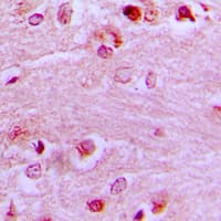Polyclonal Rabbit anti-Human EZH1 / ENX-2 Antibody (Internal, IHC, IF, WB)