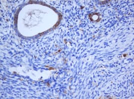 KRT5 / CK5 / Cytokeratin 5 Antibody (Conserved Region, clone OTI1C7, Carrier-free)