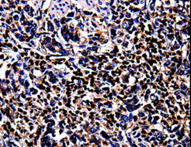 S100A4 / FSP1 Antibody