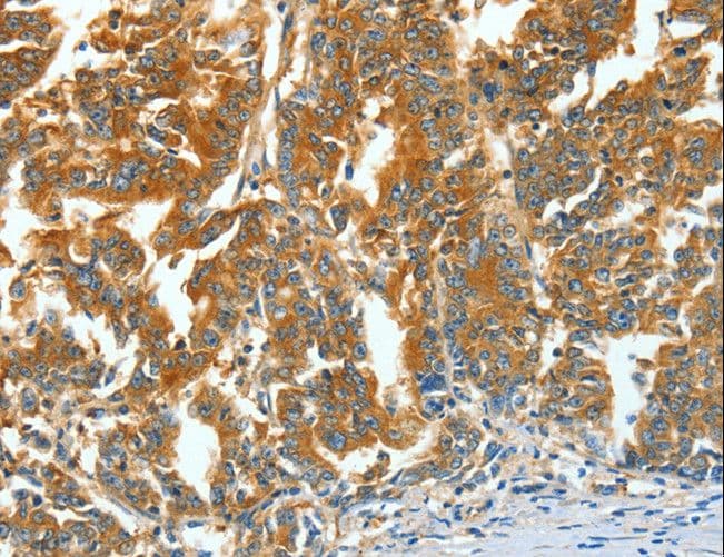 ASNS Antibody