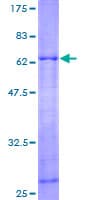 Human ARPC1A Protein (Recombinant GST)