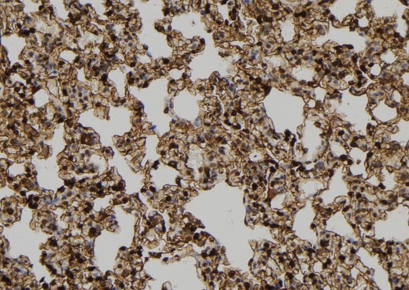 CCNB2 / Cyclin B2 Antibody