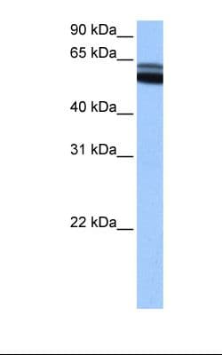 Polyclonal Rabbit anti-Human RARB / RAR Beta Antibody (C-Terminus, IHC, WB)