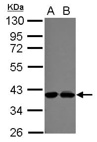 POLDIP3 / p46 Antibody