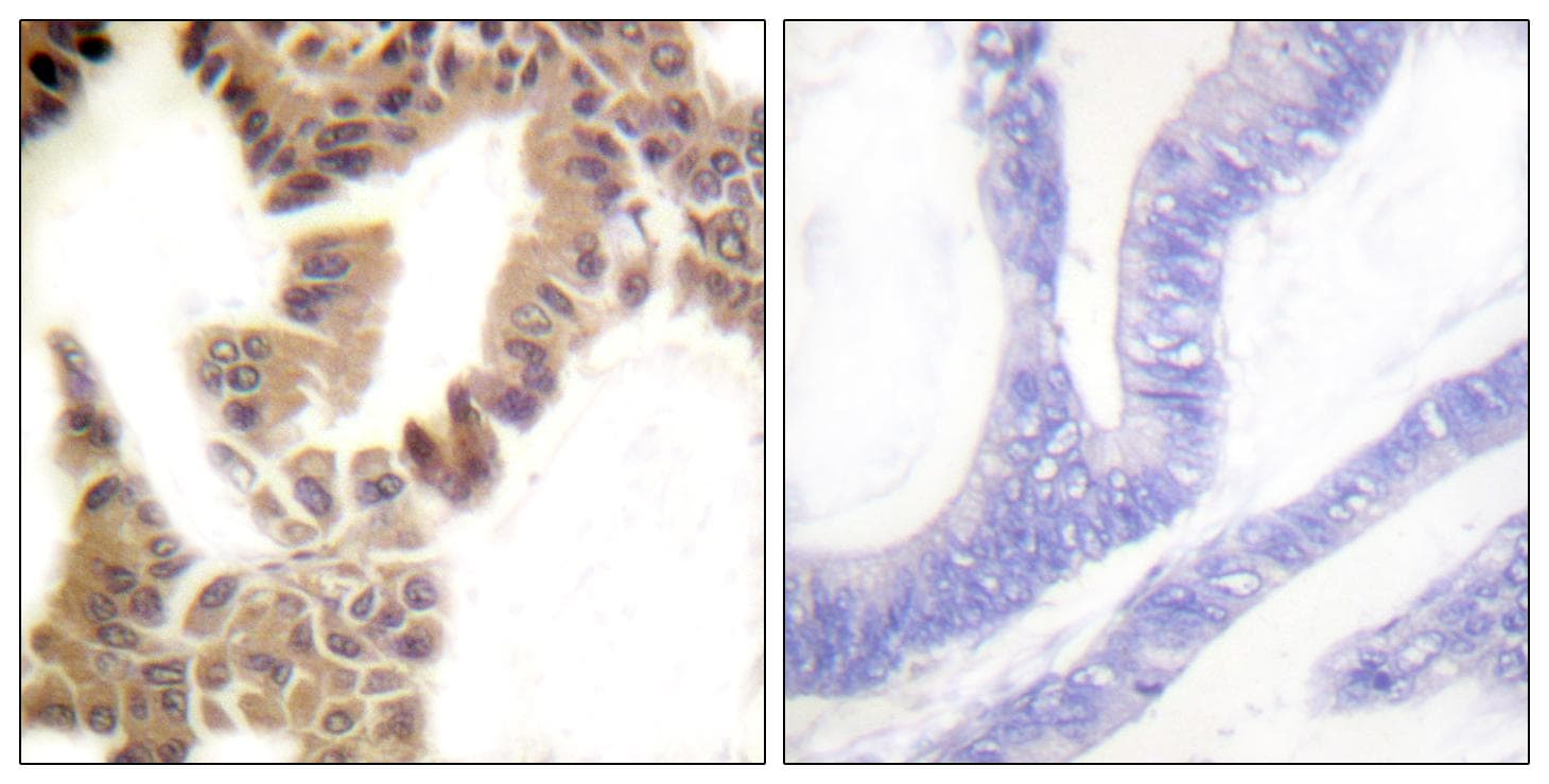 Polyclonal Rabbit anti-Human CASP2 / Caspase 2 Antibody (phospho-Ser157, IHC)