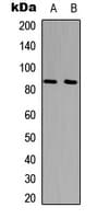 IHC-plus™ Polyclonal Rabbit anti-Human UTP14A Antibody (Internal, IHC, IF, WB)