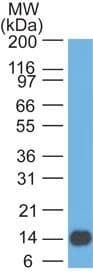 IHC-plus™ Monoclonal Mouse anti-Human NT5E / eNT / CD73 Antibody (clone 45M4F9, Azide-free, aa169-324, IHC, WB)