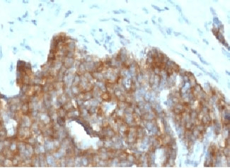 TFF1 / pS2 Antibody (C-Terminus, clone BCEIP1)