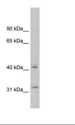 YWHAQ / 14-3-3 Theta Antibody (aa45-94)