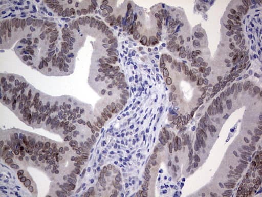 Monoclonal Mouse anti-Human HDAC9 Antibody (clone OTI3D10, aa181-460, IHC)