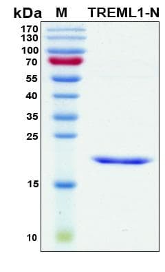 Human TREML1 / TLT1 Protein (Recombinant His, N-Terminal)