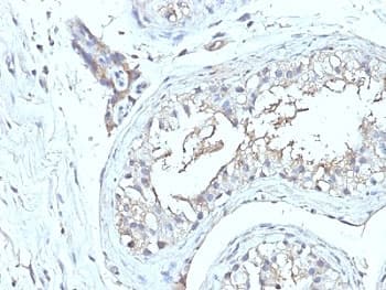 CD63 Antibody (clone NKI/C3 + LAMP3/968)