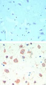 KAT5 / TIP60 Antibody (aa480-530)