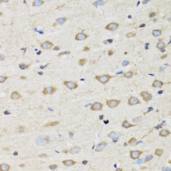 Polyclonal Rabbit anti-Human CLIC4 Antibody (IHC, IF, WB)