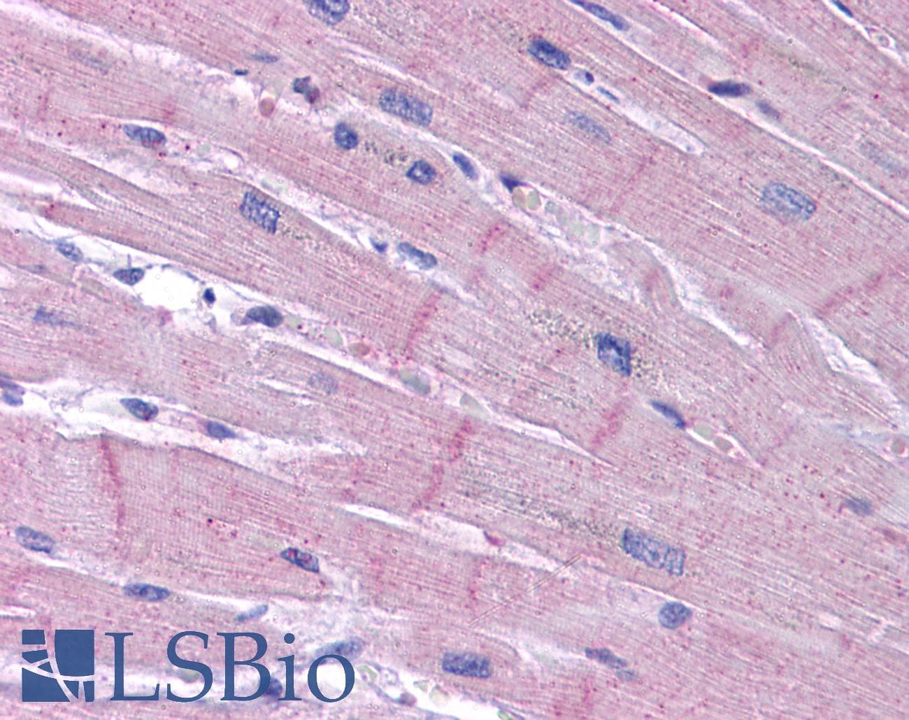 IHC-plus™ Polyclonal Rabbit anti-Human KCNK18 / TRESK Antibody (IHC, IF, WB)