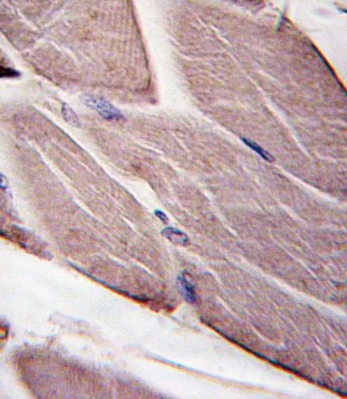 PDK4 Antibody (aa250-277)