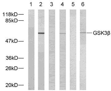 GSK3B / GSK3 Beta Antibody (p9)