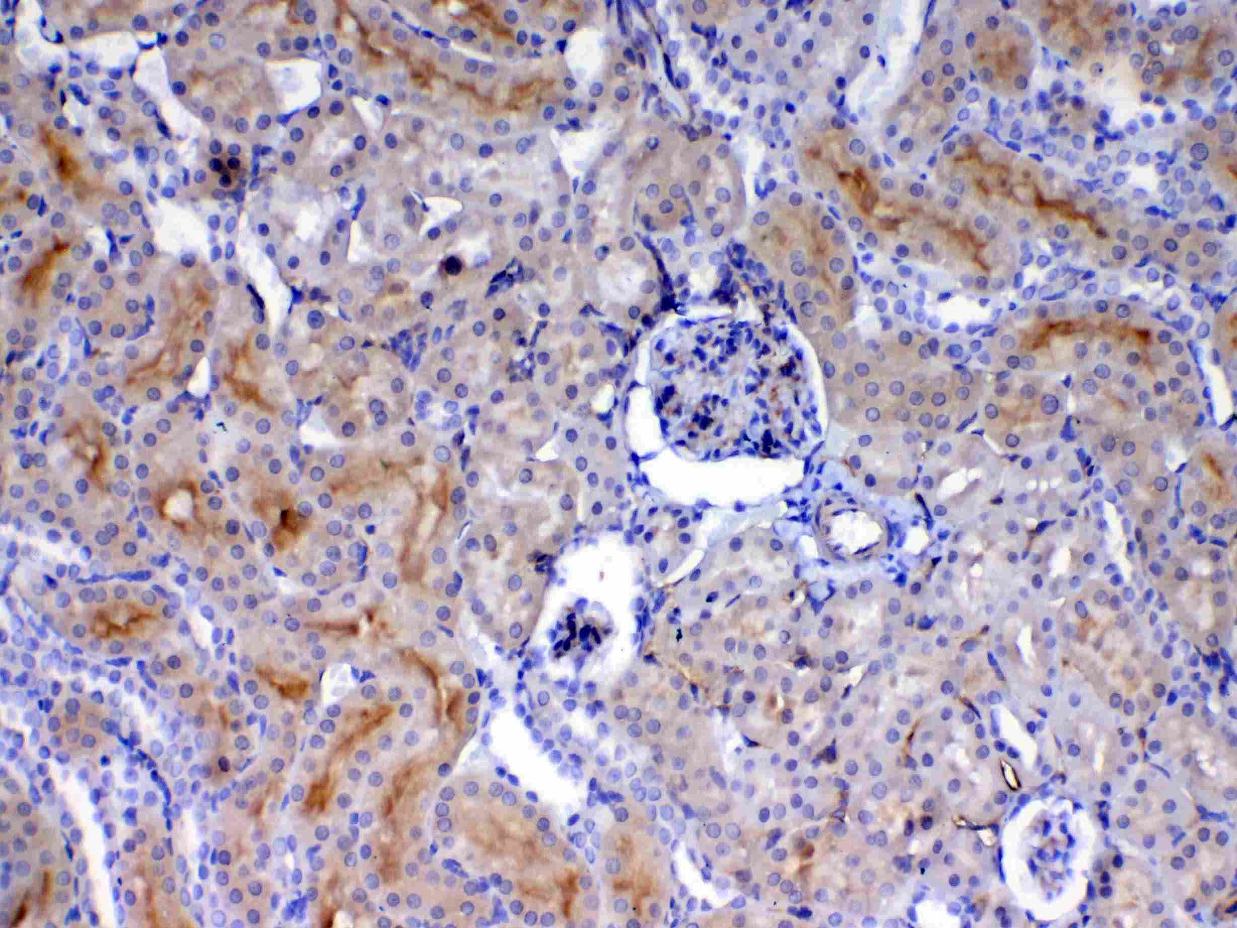 CD105 Antibody