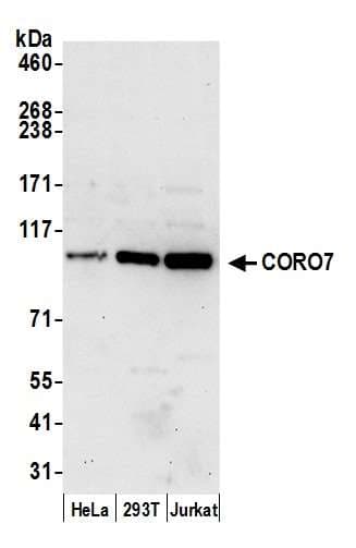 Polyclonal Rabbit anti-Human Coronin 7 / CORO7 Antibody (aa875-925, WB)