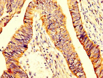 Polyclonal Rabbit anti-Human MYOC / Myocilin Antibody (IHC, WB)