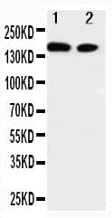 ERBB4 / HER4 Antibody (aa35-51)
