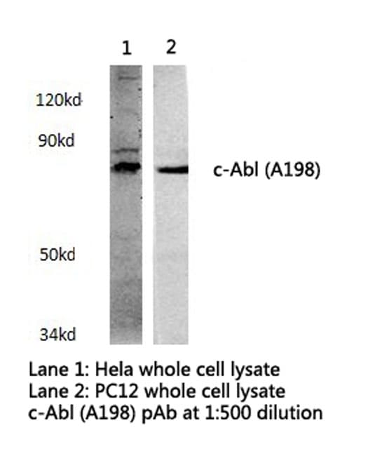 ABL1 / c-ABL Antibody (Ala198)