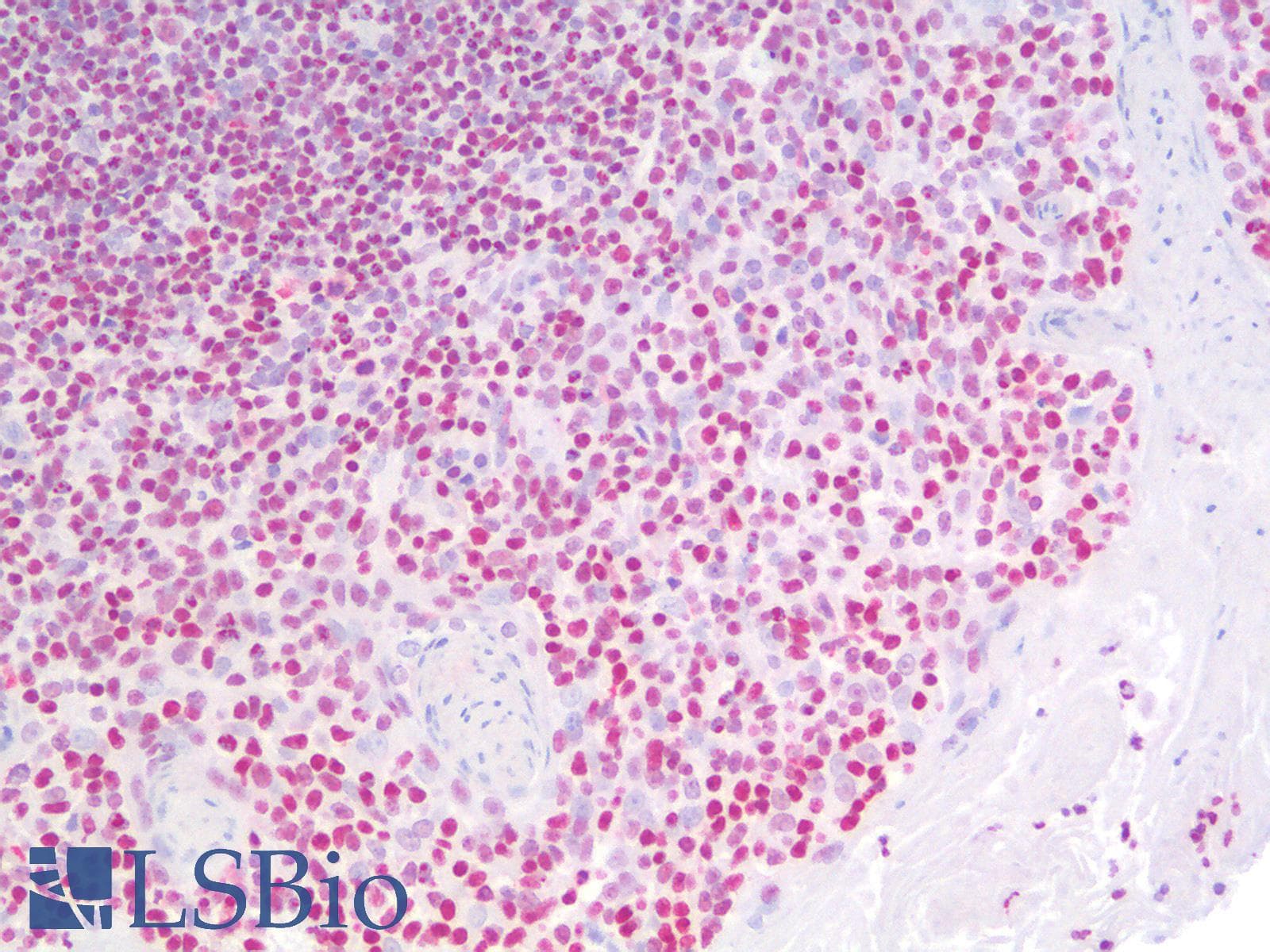 IHC-plus™ Polyclonal Rabbit anti-Mouse HMG1 / HMGB1 Antibody (IHC, IF, WB)