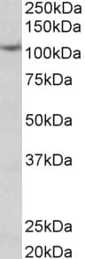 PathPlus™ TPO / Thyroid Peroxidase Antibody (aa850-C-term)