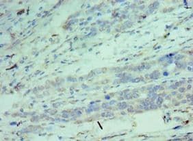 CDK9 Antibody (aa153-372)