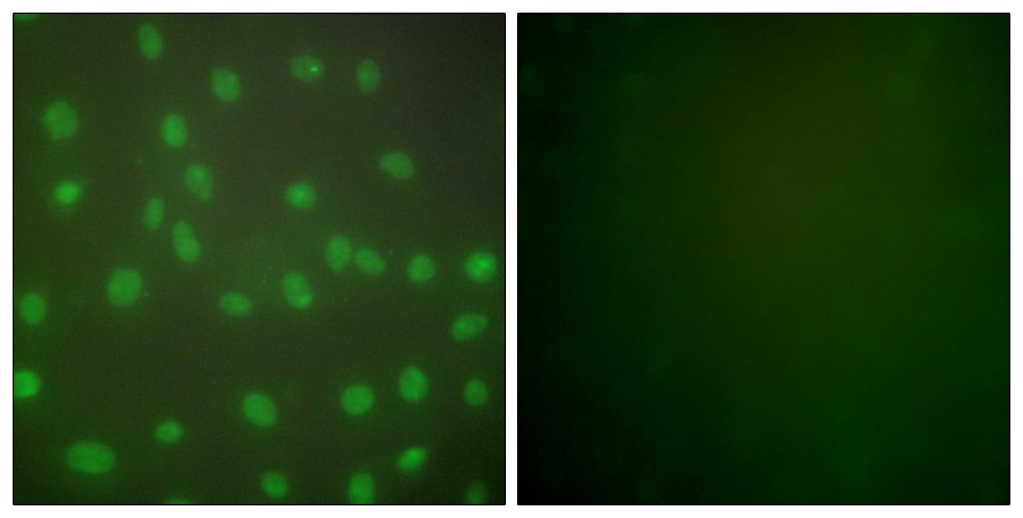 IHC-plus™ Polyclonal Rabbit anti-Human HDAC1 Antibody (aa433-482, IHC, IF, WB)