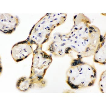 UPF3B Antibody (aa416-452)