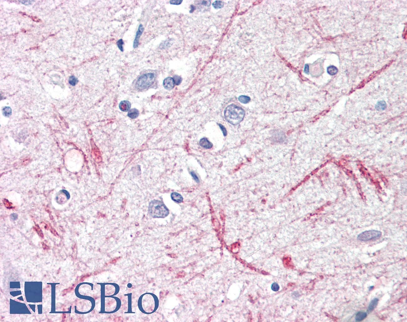 IHC-plus™ DTX3 Antibody (aa19-30)