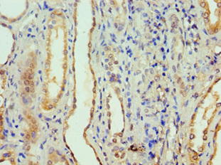 APCS / Serum Amyloid P / SAP Antibody (aa1-223)